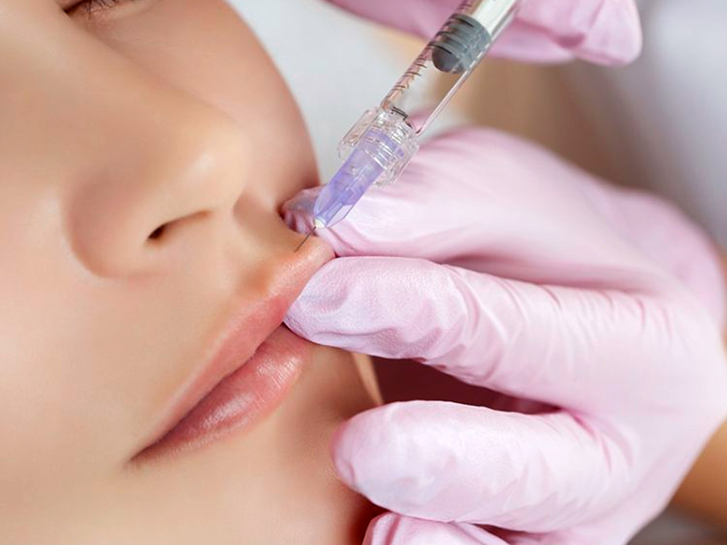 Cómo tener unos labios más carnosos y apetecibles