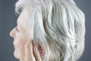 alopecia-y-el-consumo-de-medicamentos-en-la-tercera-edad