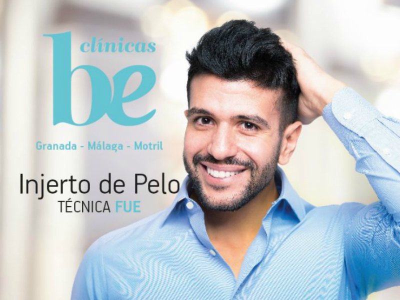 Injerto capilar en Málaga