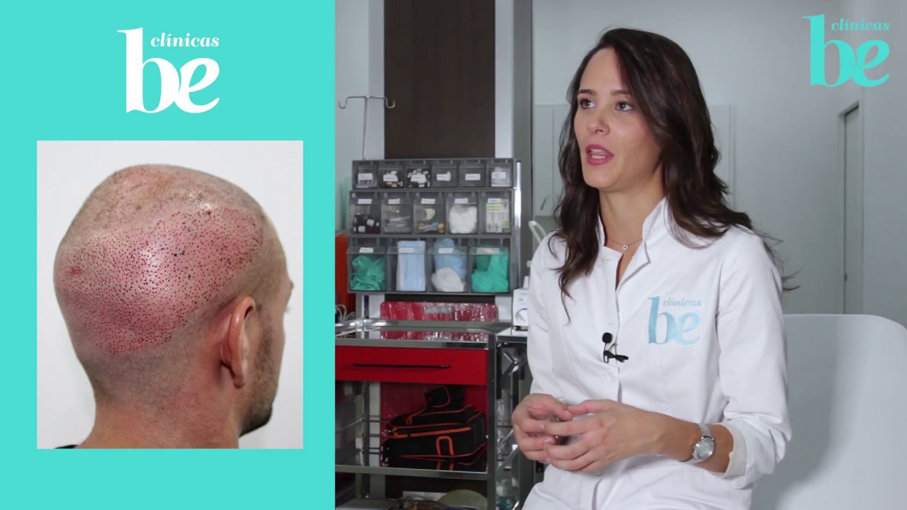 Microtrasplante capilar Clínicas Be