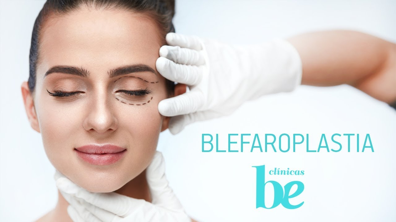 blefaroplastia en la tercera edad