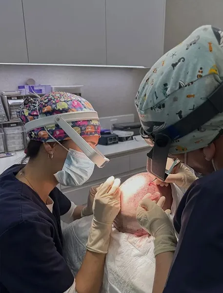 Cirujanos realizando un implante capilar en Clínicas be