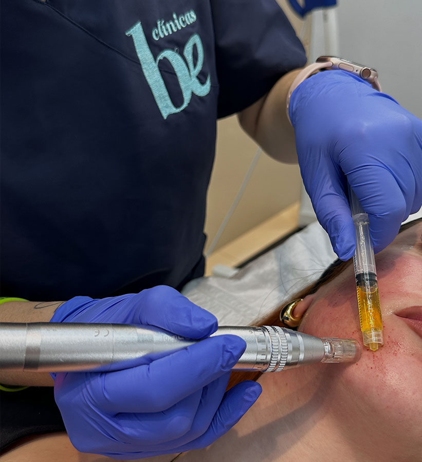 manchas-faciales-tratamiento-granada