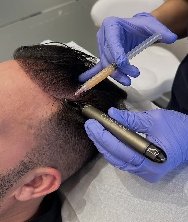 paciente en consulta de salud capilar en clínica be granada